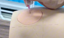 肌肉注射操作视频,步骤与技巧全解析